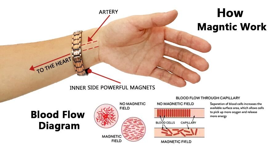 Do Magnetic Therapy Bracelets Work