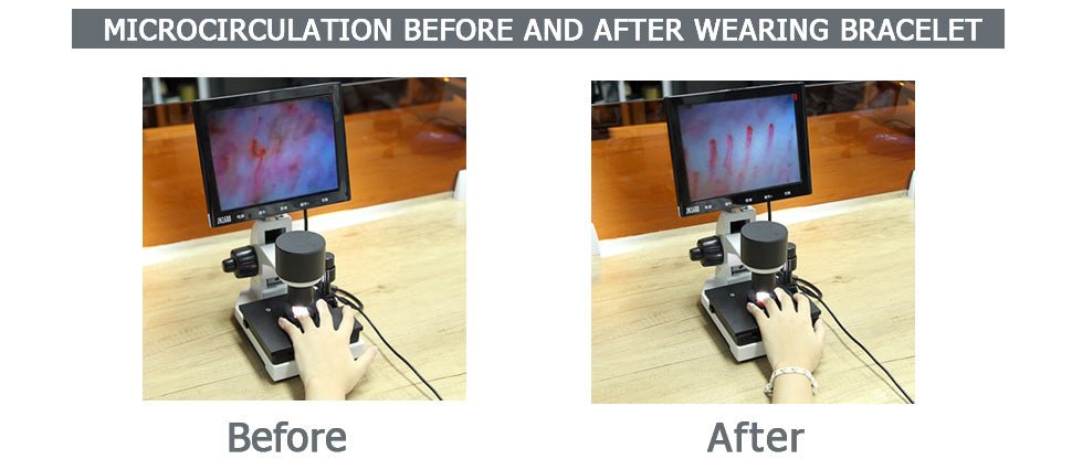 Microcirculation Before And After Wearing Bracelet